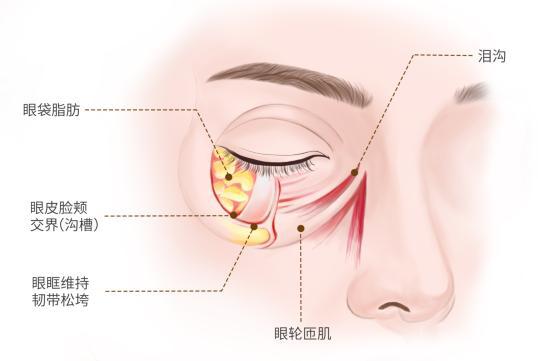 的标志去除眼袋焕发青春光彩米乐m6眼袋不是自然衰老(图1)